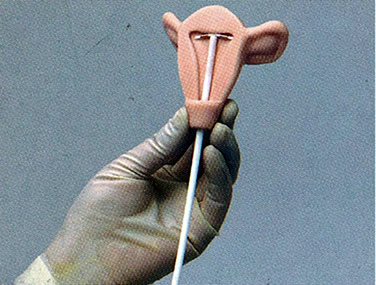 高级宫内避孕器训练模型