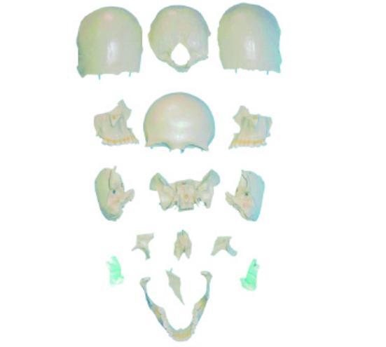 分离头颅骨散骨模型