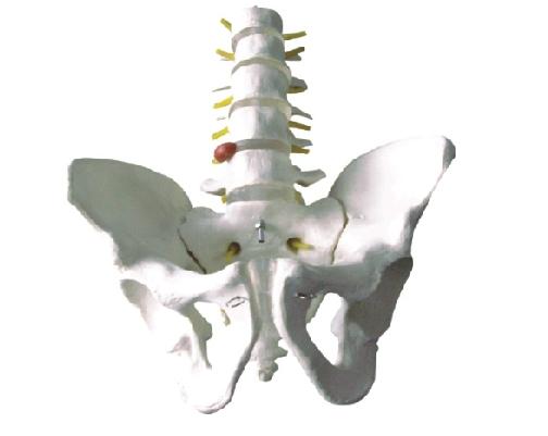 骨盆带五节腰椎模型