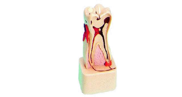 4倍牙体病理模型