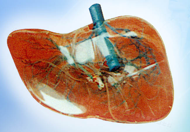 透明肝脏模型