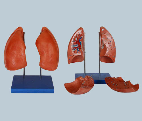 肺模型