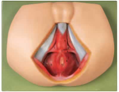 男性会阴解剖模型