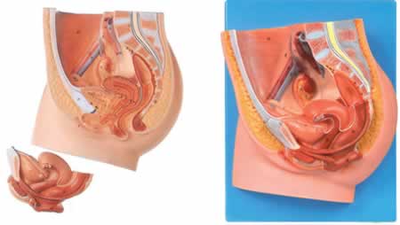女性盆腔正中矢状切面模型（3件）