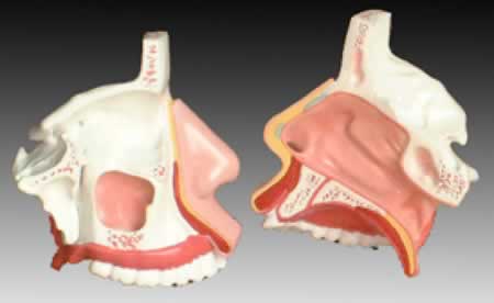 鼻骨放大模型