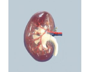 透明肾脏模型